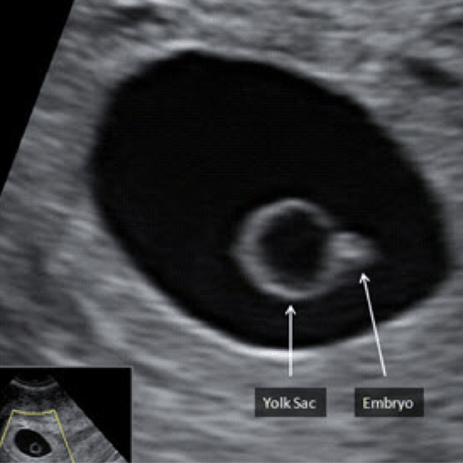 Male doctor standing with arms crossed in corrirdor