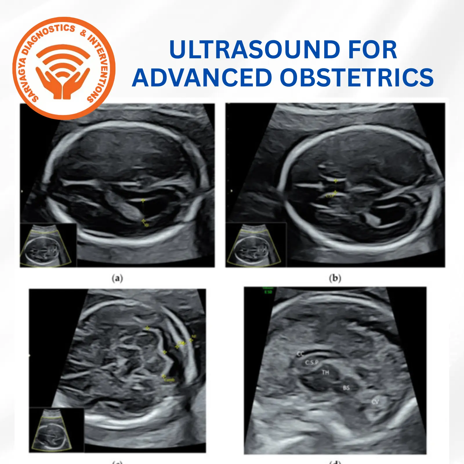 Male doctor standing with arms crossed in corrirdor